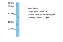 TMEM178 Rabbit anti-Mouse, Polyclonal, Novus Biologicals 0.1 mL | Buy Online | Novus Biologicals | Fisher Scientific